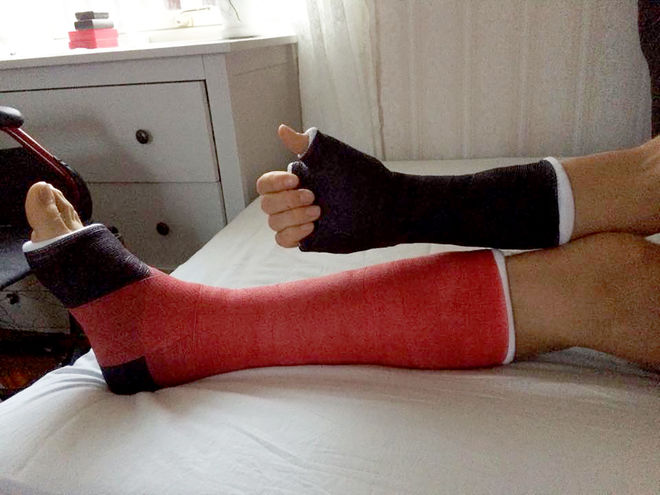 MED GIPSAD hand och fot och operation som väntar nästa vecka har inte Jens Eriksson fått den säsongsuppladdningen han hade hoppats på. Foto: PRIVAT