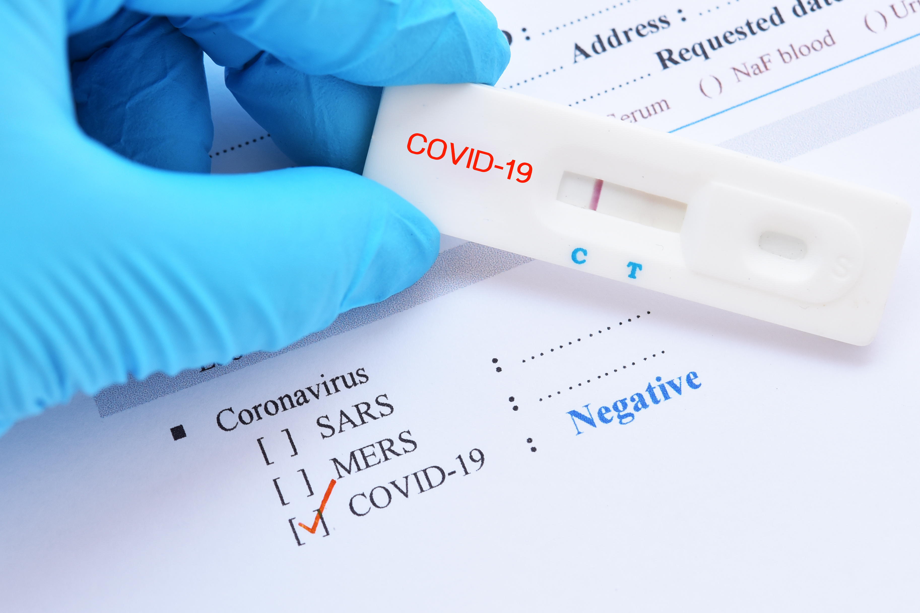 Negative test result by using rapid test device for COVID-19, no