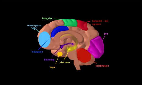 Hjernekart