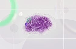 fiolett hjerne