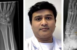 Fotomontasje med mann med røntgenbilde av hånd på hver side